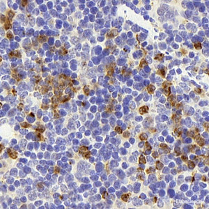 Immunohistochemistry analysis of paraffin-embedded mouse spleen using CD177 Polyclonal Antibody at dilution of 1:300.