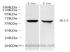 Western Blot analysis of various samples using DLL3 Polyclonal Antibody at dilution of 1:1000.