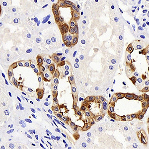 Immunohistochemistry analysis of paraffin-embedded human kidney using COL18A1 Polyclonal Antibody at dilution of 1:400.