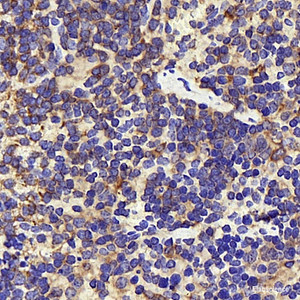 Immunohistochemistry analysis of paraffin-embedded mouse inflammation spleen using INPP5D Polyclonal Antibody at dilution of 1:300.