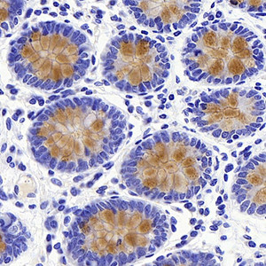 Immunohistochemistry analysis of paraffin-embedded human colon using MUC2 Polyclonal Antibody at dilution of 1:600.