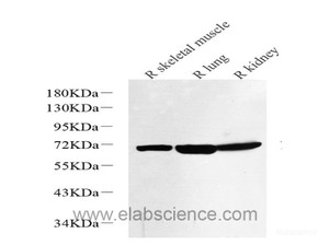 Western Blot analysis of various samples using NOX4 Polyclonal Antibody at dilution of 1:1000.