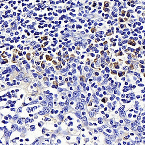Immunohistochemistry analysis of paraffin-embedded human tonsil using SIRT7 Polyclonal Antibody at dilution of 1:200.