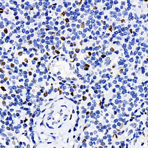 Immunohistochemistry analysis of paraffin-embedded human tonsil using ERK 2 Polyclonal Antibody at dilution of 1:100.