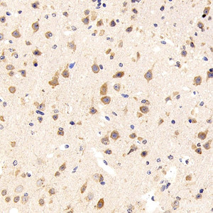 Immunohistochemistry analysis of paraffin-embedded mouse brain using GRIN1 Polyclonal Antibody at dilution of 1:300.