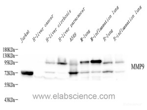 Western Blot analysis of various samples using MMP9 Monoclonal Antibody at dilution of 1:1000.
