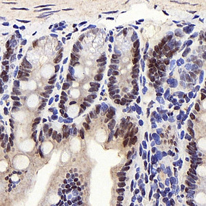 Immunohistochemistry analysis of paraffin-embedded mouse colon using PPARA Polyclonal Antibody at dilution of 1:300.
