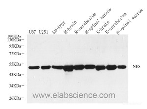 Western Blot analysis of various samples using ENO2 Polyclonal Antibody at dilution of 1:2000.