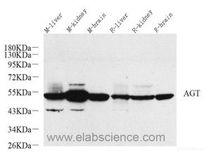 Western Blot analysis of various samples using AGT Polyclonal Antibody at dilution of 1:600.