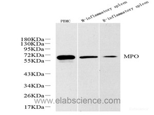 Western Blot analysis of various samples using MPO Polyclonal Antibody at dilution of 1:1000.