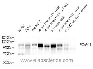 Western Blot analysis of various samples using VCAM1 Polyclonal Antibody at dilution of 1:600.