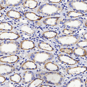 Immunohistochemistry analysis of paraffin-embedded human kidney using DICER1 Polyclonal Antibody at dilution of 1:400.