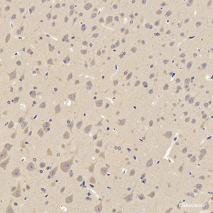 Immunohistochemistry analysis of paraffin-embedded rat cortex using TAC1 Polyclonal Antibody at dilution of 1:300.