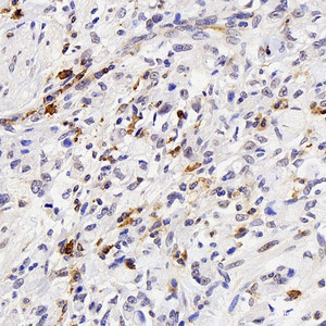 Immunohistochemistry analysis of paraffin-embedded human appendix using FAS Polyclonal Antibody at dilution of 1:500.