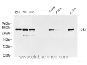 Western Blot analysis of various samples using c-Kit Polyclonal Antibody at dilution of 1:800.