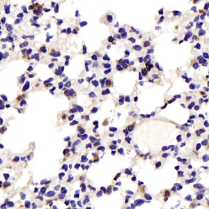 Immunohistochemistry analysis of paraffin-embedded Mouse lung using JNK1/2/3 Polyclonal Antibody at dilution of 1:200.