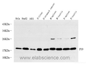 Western Blot analysis of various samples using p19 INK4d Polyclonal Antibody at dilution of 1:500.
