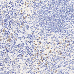 Immunohistochemistry analysis of paraffin-embedded mouse spleen using CCR5 Polyclonal Antibody at dilution of 1:300.