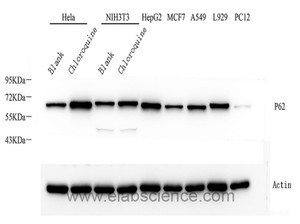 Western Blot analysis of various samples using P62/SQSTM1 Polyclonal Antibody at dilution of 1:1000.