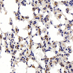 Immunohistochemistry analysis of paraffin-embedded mouse lung using CD68 Polyclonal Antibody at dilution of 1:300.