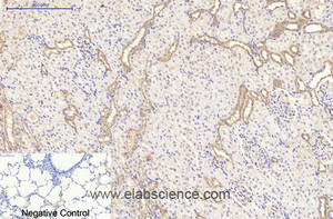 Immunohistochemistry of paraffin-embedded Rat lung tissue using CD20 Monoclonal Antibody at dilution of 1:200.