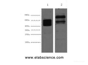 Western Blot analysis of 1) Hela, 2) Mouse brain using CK-8 Monoclonal Antibody at dilution of 1:4000.
