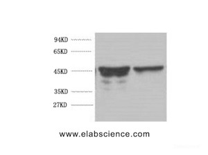 Western Blot analysis of Rat brain using GFAP Monoclonal Antibody at dilution of 1:5000.