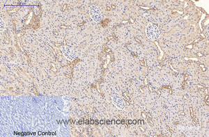 Immunohistochemistry of paraffin-embedded Rat kidney tissue using CD21 Monoclonal Antibody at dilution of 1:200.