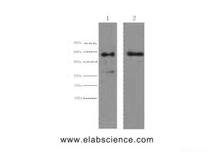 Western Blot analysis of 1) Hela, 2) HepG2 cells using CK-6A/B/C Monoclonal Antibody at dilution of 1:2000.