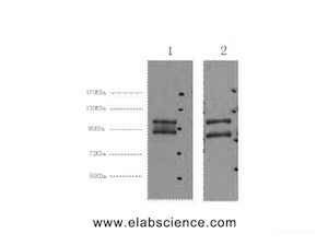 Western Blot analysis of 1) Hela, 2) HepG2 cells using IDE Monoclonal Antibody at dilution of 1:2000.