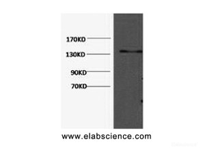 Western Blot analysis of Hela cells using COL3A1 Monoclonal Antibody at dilution of 1:1000.