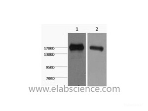 Western Blot analysis of 1) A431, 2) Hela cells using EGFR Monoclonal Antibody at dilution of 1:2000.