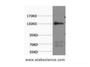 Western Blot analysis of Rat heart using NOS3 Monoclonal Antibody at dilution of 1:1000.