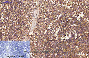 Immunohistochemistry of paraffin-embedded Human tonsil tissue using CD1A Monoclonal Antibody at dilution of 1:200.