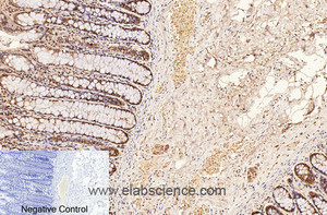 Immunohistochemistry of paraffin-embedded Human colon tissue using CD2 Monoclonal Antibody at dilution of 1:200.