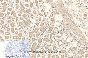 Immunohistochemistry of paraffin-embedded Human stomach tissue using CD4 Monoclonal Antibody at dilution of 1:200.