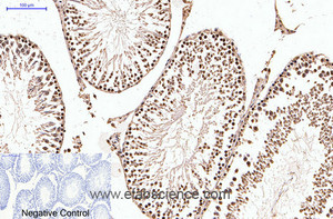 Immunohistochemistry of paraffin-embedded Rat testis tissue using PGR Monoclonal Antibody at dilution of 1:200.