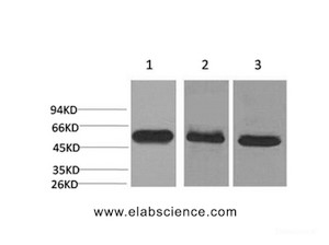 Western Blot analysis of 1) Hela, 2) Mouse brain, 3) Rat brain with CASP8 Monoclonal Antibody