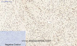 Immunohistochemistry of paraffin-embedded Human uterus tissue using PPARD Monoclonal Antibody at dilution of 1:200.