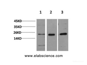 Western Blot analysis of 1) Hela, 2) 3T3, 3) PC-12 cells using CBX5 Monoclonal Antibody at dilution of 1:1000.
