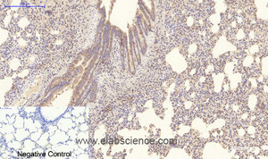 Immunohistochemistry of paraffin-embedded Rat lung tissue using COL4A1 Monoclonal Antibody at dilution of 1:200.