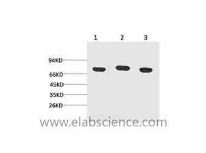 Western Blot analysis of 1) Hela, 2) Mouse brain, 3) Rat brain using HSPA8 Monoclonal Antibody at dilution of 1:2000.