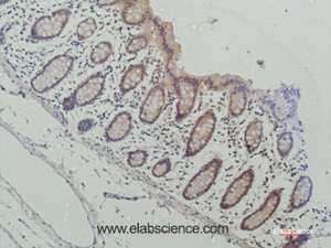 Immunohistochemistry of paraffin-embedded Human colon using Galectin 3 Monoclonal Antibody at dilution of 1:50.