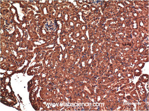 Immunohistochemistry of paraffin-embedded Mouse kidney tissue using Bax Monoclonal Antibody at dilution of 1:200.