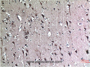 Immunohistochemistry of paraffin-embedded Human brain tissue using BECN1 Monoclonal Antibody at dilution of 1:200.