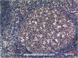 Immunohistochemistry of paraffin-embedded Human tonsil tissue using MLKL Monoclonal Antibody at dilution of 1:200.