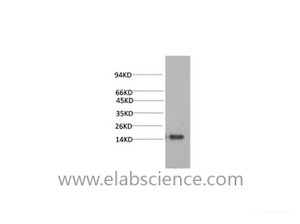 Western Blot analysis of Human serum using TTR Monoclonal Antibody at dilution of 1:2000.