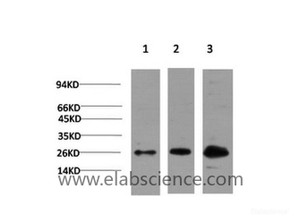 Western Blot analysis of 1) Hela, 2) 3T3, 3) PC12 cells using CBX3 Monoclonal Antibody at dilution of 1:1000.