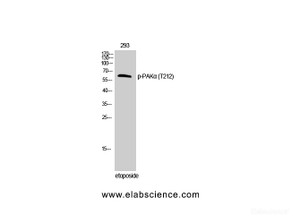 Western Blot analysis of 293T cells with Phospho-PAK1 (Thr212) Polyclonal Antibody