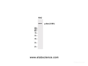Western Blot analysis of K562 cells with Phospho-Atm (Ser1981) Polyclonal Antibody at dilution of 1:500